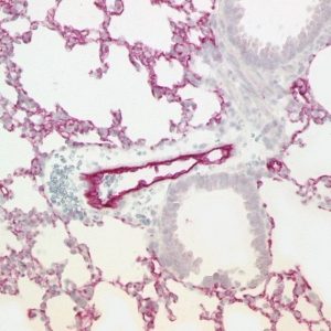 Alveolar capillaries and vessels in lung tissue