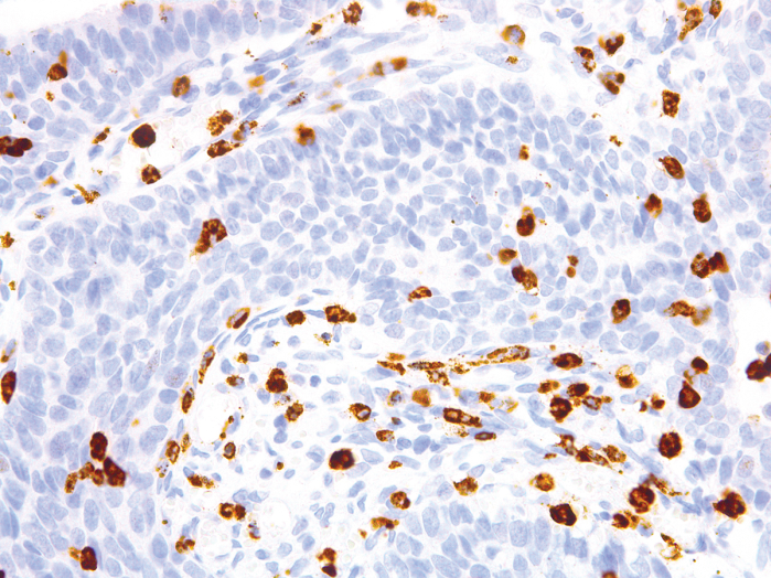 Antikörper Anti-CD15 (LEU-M1) (Hu) aus Maus (IHC527) - unkonj.