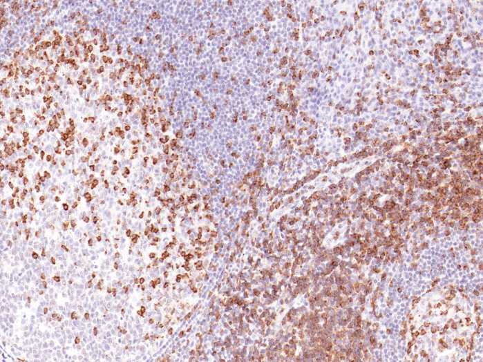 Antikörper Anti-CD2 (Hu) aus Maus (IHC531) - unkonj.
