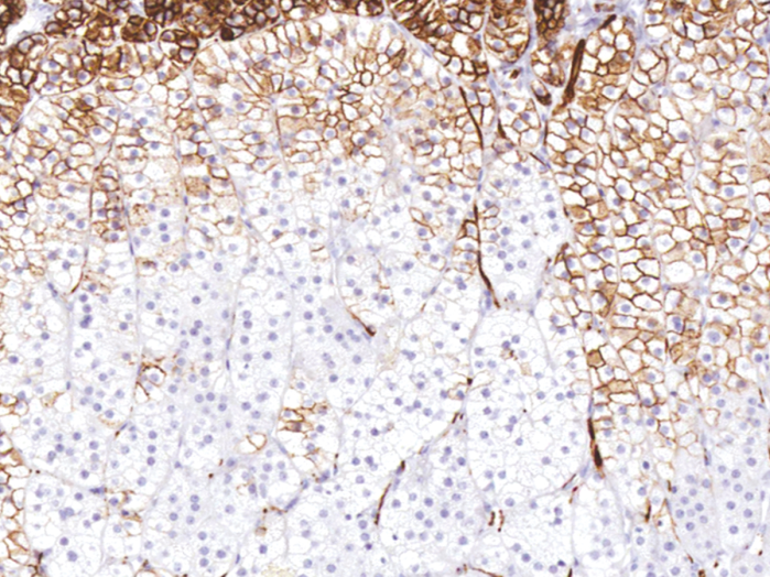 Antikörper Anti-CD56 (NCAM) (Hu) aus Maus (IHC056) - unkonj.