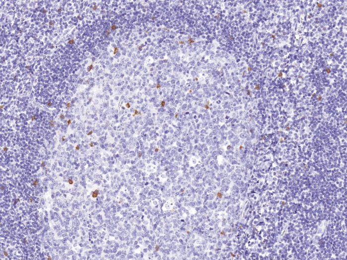 Antikörper Anti-CD57/B3GAT1/HNK1 (Hu) aus Maus (IHC539) - unkonj.
