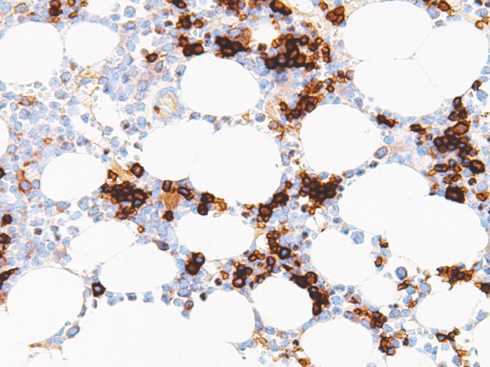 Antikörper Anti-CD71 (Hu) aus Maus (IHC071) - unkonj.