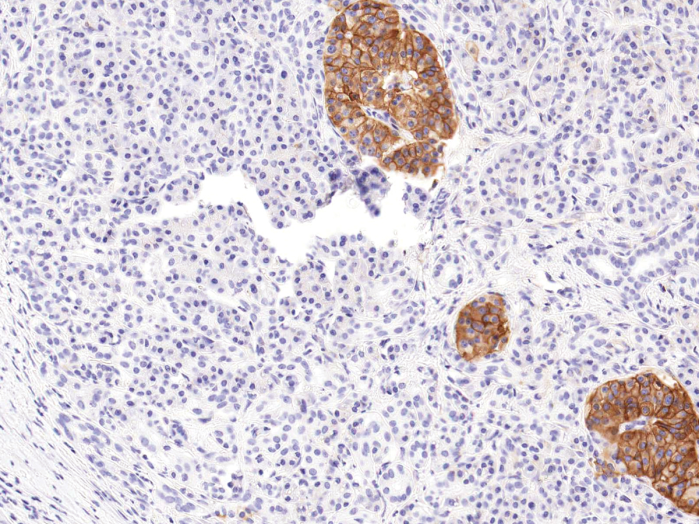 Antikörper Anti-CD99 (Hu) aus Maus (IHC099) - unkonj.