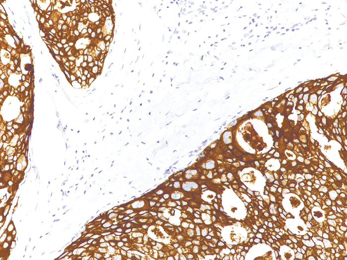 Antibody Anti-Her2/neu (ErbB2) (Hu) from Mouse (IHC002) - unconj.