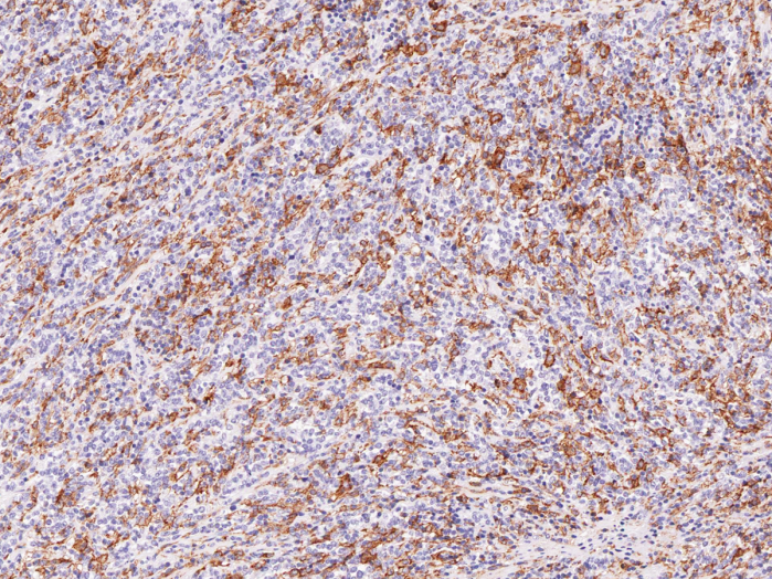 Antibody Anti-Hairy Cell Leukemia (Hu) from Mouse (IHC687) - unconj.