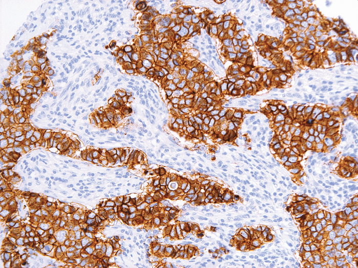 Antikörper Anti-Her2/neu (Hu) aus Maus (IHC042) - unkonj.
