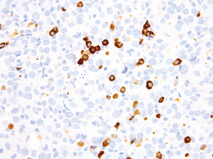 Antibody Anti-Immunoglobulin G kappa (IgG kappa) (Hu) from Mouse (IHC610) - unconj.