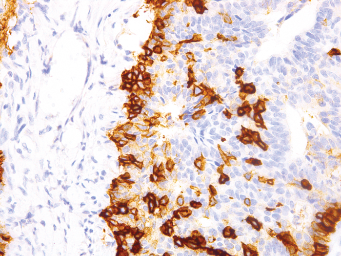 Antikörper Anti-NGFR (TNFRSF16) (Hu) aus Maus (IHC637) - unkonj.