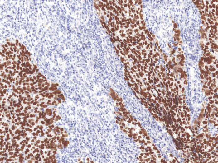 Antibody Anti-Sal-like protein 4 (SALL4) (Hu) from Mouse (IHC659) - unconj.