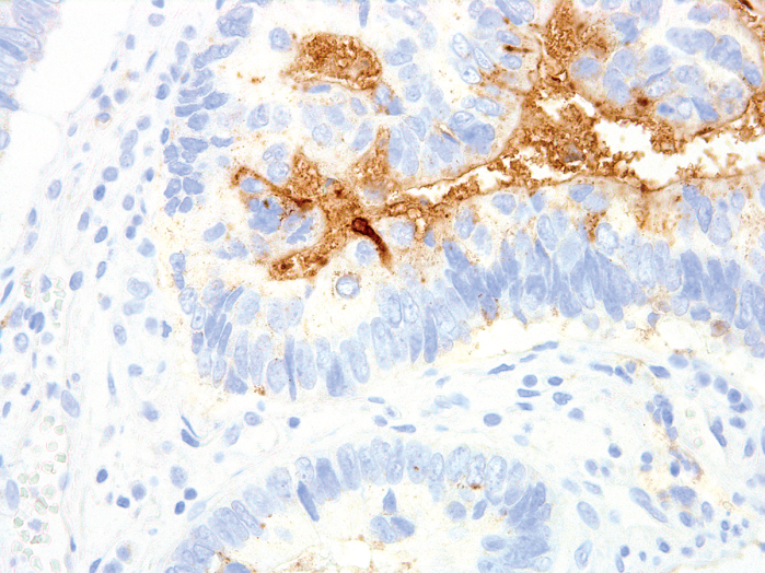 Antikörper Anti-Tumor-associated glycoprotein 72 (Tag-72) (Hu) aus Maus (IHC072) - unkonj.
