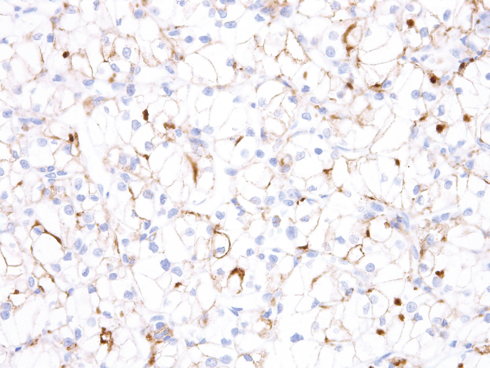Antibody Anti-T-Cell Immunoglobulin Mucin-3 (TIM-3) (Hu) from Mouse (IHC003) - unconj.
