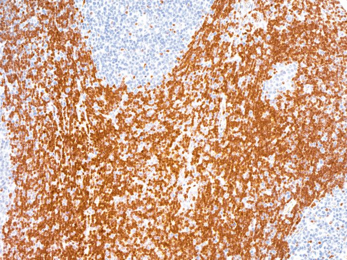 Antikörper Anti-p27 (Hu) aus Maus (IHC027) - unkonj.