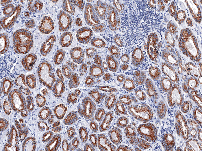 Antikörper Anti-AMACR (p504s) (Hu) aus Maus (IHC504) - unkonj.