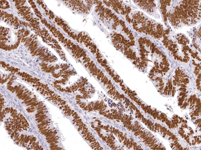 Antibody Anti-p53 tumor suppressor (p53) (Hu) from Mouse (IHC053) - unconj.