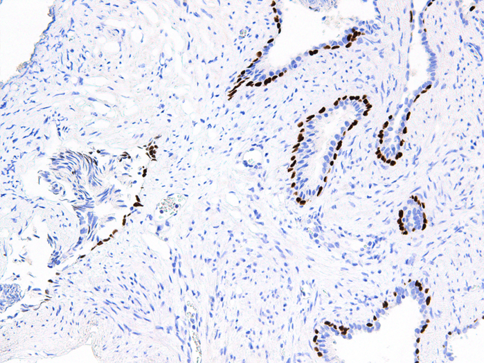 Antibody Anti-p63 (TP63) (Hu) from Mouse (IHC063) - unconj.