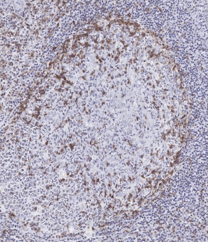 DIA-TG2-M Antikörper Klon TG2 gegen TIGIT 