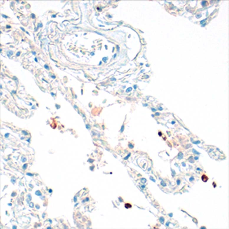 Immunohistochemistry Anti SARS-CoV-2 Antibody S1 IHC-184005 (Clone HL134)