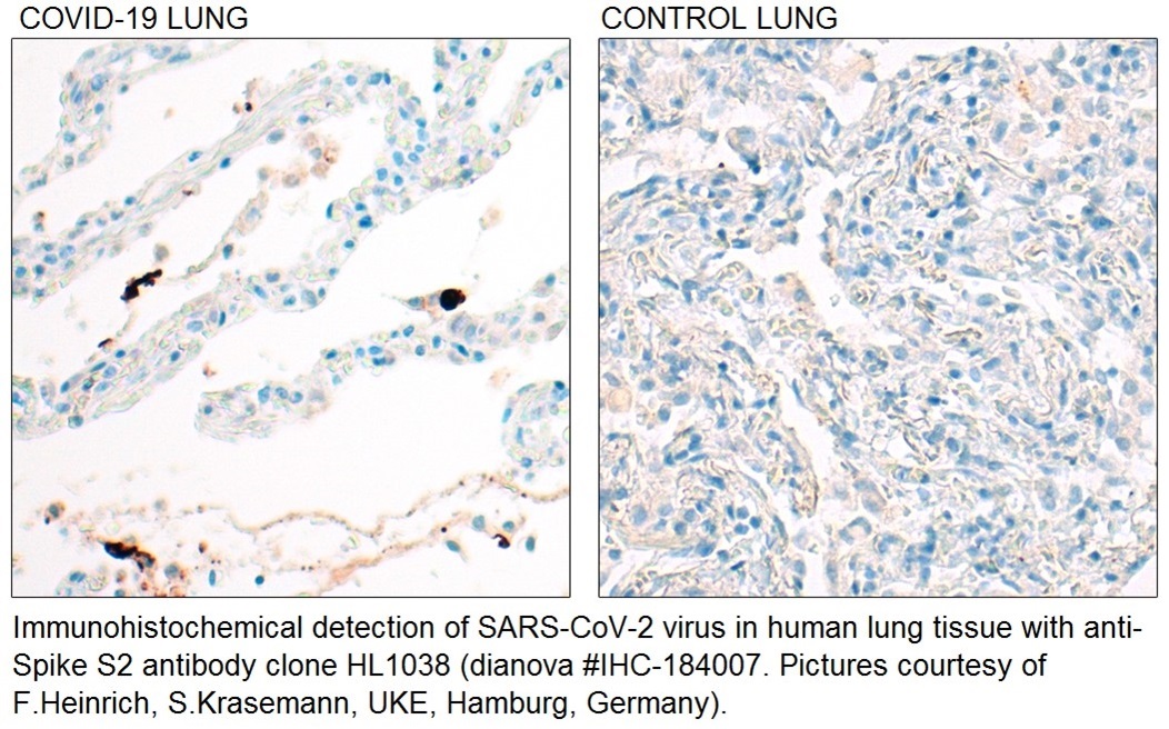 Immunhistochemie Anti-SARS-CoV-2 Antikörper S2 IHC-184007 (Klon HL1038 )