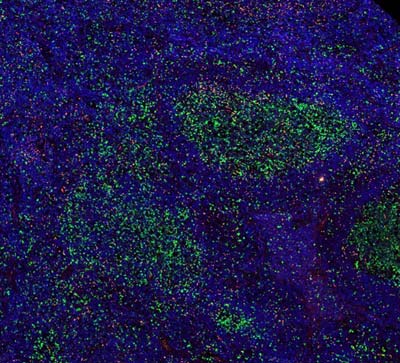 Fig.01 Immunofluorescence of FOXP3 (red) and CD112R (green), magnification 4x