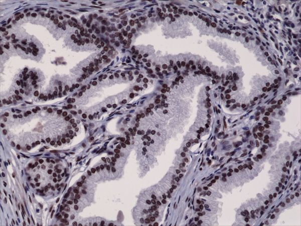 Fig1_prostate-cancer_ARNT_E