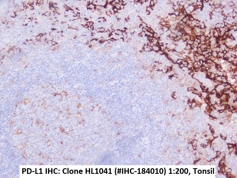 Immunohistochemie mit anti-PD-L1 Klon HL1041 in humaner Tonsille (FFPE)
