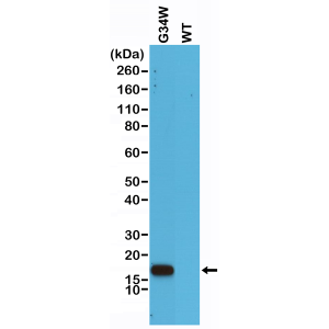 Anti-Histone H3.3 G34W (alle) aus Kaninchen (RM263) - unkonj.