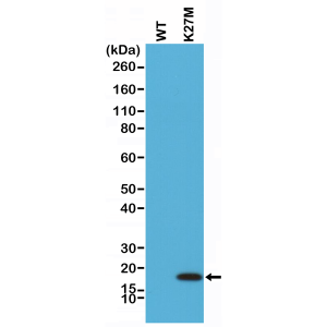 Anti-Histone H3 (K27M) (alle) aus Kaninchen (RM192) - unkonj.