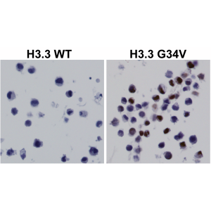 Anti-Histone H3.3 G34V (all) from Rabbit (RM307) - unconj.
