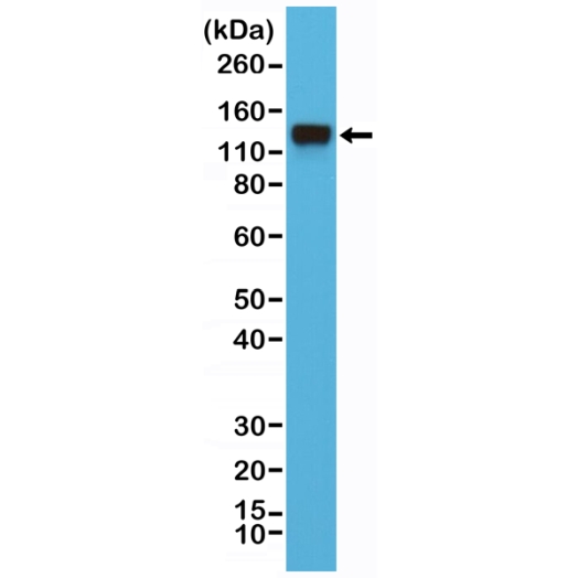 Antikörper Anti-Integrin Beta-1 (ITGB1) aus Kaninchen (RM285) - unkonj.