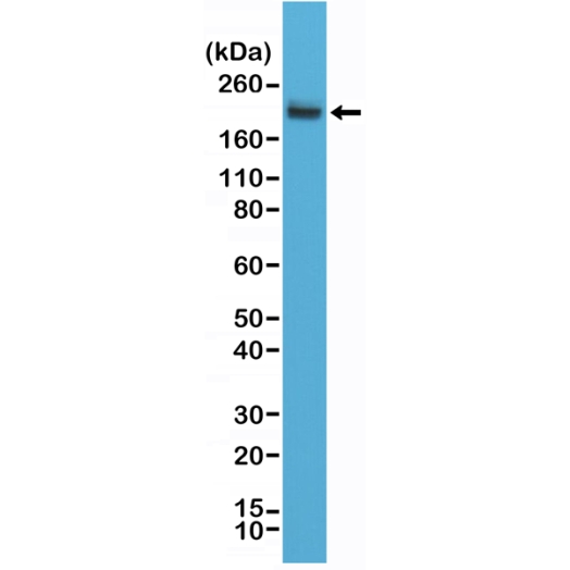 Antikörper Anti-CD45 (PTPRC) aus Kaninchen (RM291) - unkonj.