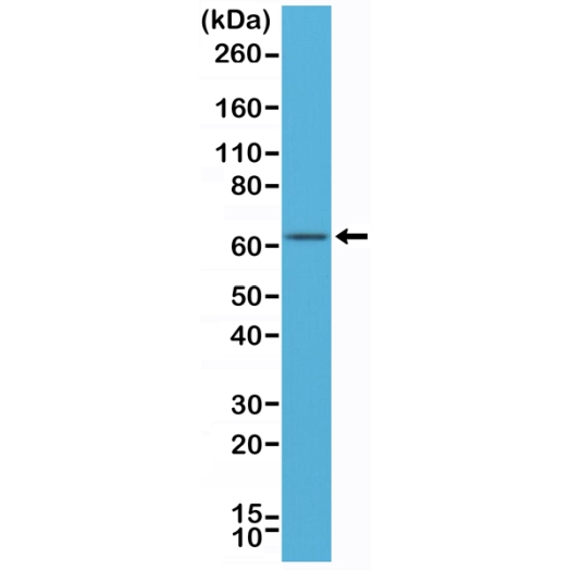 Antikörper Anti-ER alpha aus Kaninchen (RM292) - unkonj.