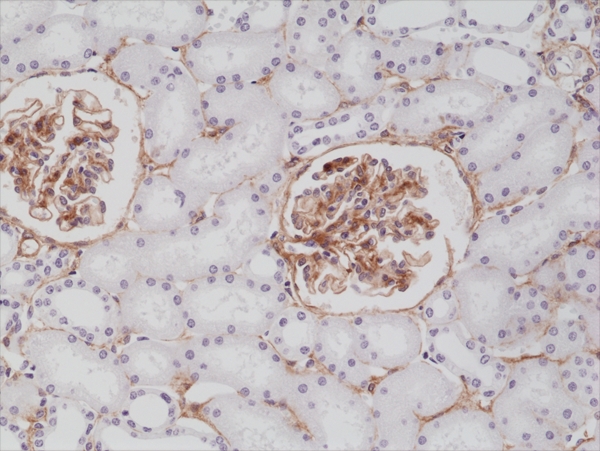 Antikörper Anti-Platelet-derived Growth Factor Receptor beta (PDGFRB) aus Kaninchen (RM303) - unkonj.