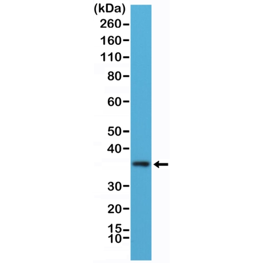 Antikörper Anti-Myeloid differentiation primary response protein MyD88 (MYD88) aus Kaninchen (RM306) - unkonj.