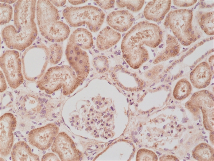 Antikörper Anti-BRAF aus Kaninchen (RM308) - unkonj.