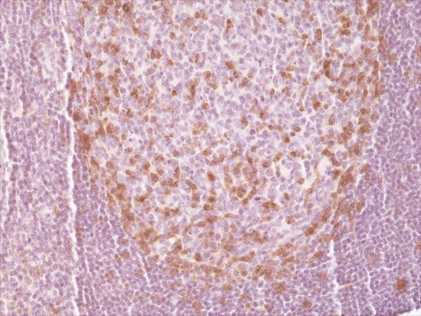 Antikörper Anti-Programmed Cell Death Protein 1 (PD-1) aus Kaninchen (RM309) - unkonj.