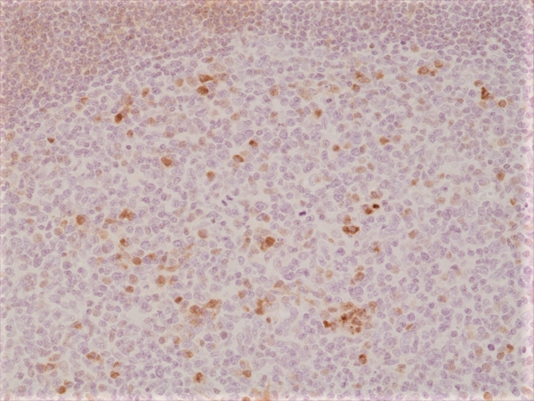 Antikörper Anti-OX40 (TNFRSF4) aus Kaninchen (RM313) - unkonj.