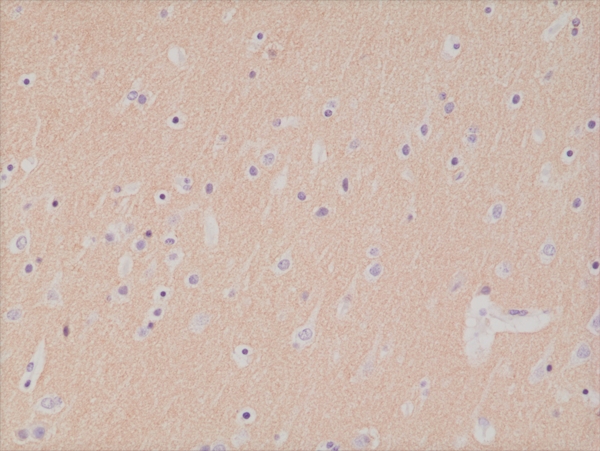 Antikörper Anti-CD56 (NCAM) aus Kaninchen (RM315) - unkonj.