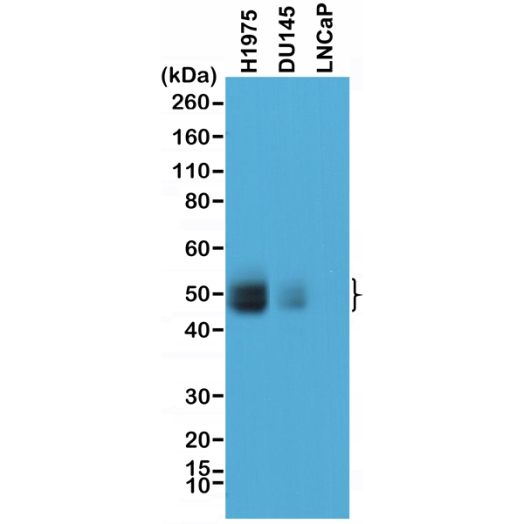 Antikörper Anti-Programmed death-ligand 1 (PD-L1) aus Kaninchen (RM320) - unkonj.