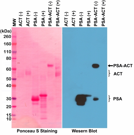 Antibody Anti-Prostate Specific Antigen (PSA, KLK3) from Rabbit - unconj.