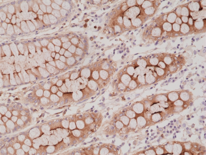 Antikörper Anti-Carcinoembryonic Antigen (CEA) aus Kaninchen (RM326) - unkonj.