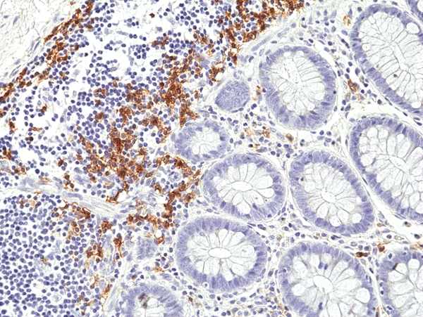 Antikörper Anti-CD19 aus Kaninchen (RM332) - unkonj.