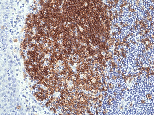 Antikörper Anti-CD19 aus Kaninchen (RM332) - unkonj.