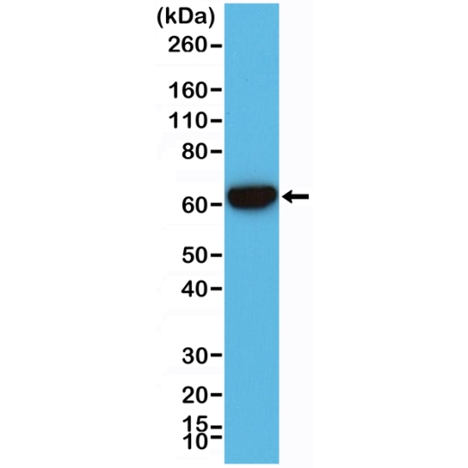 Antikörper Anti-Cytokeratin 5/Cytokeratin 6 (CK-5/CK-6) aus Kaninchen (RM341) - unkonj.