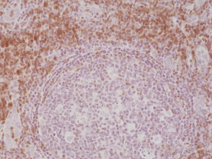 Antibody Anti-CD3E (CD3 epsilon) from Rabbit - unconj.
