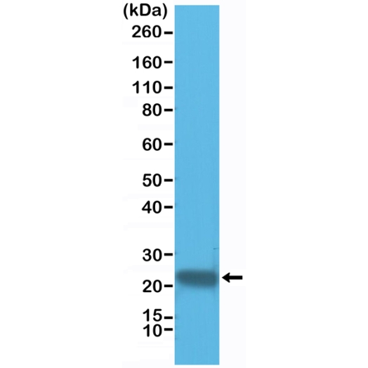 Antikörper Anti-GST3/GST pi aus Kaninchen (RM347) - unkonj.