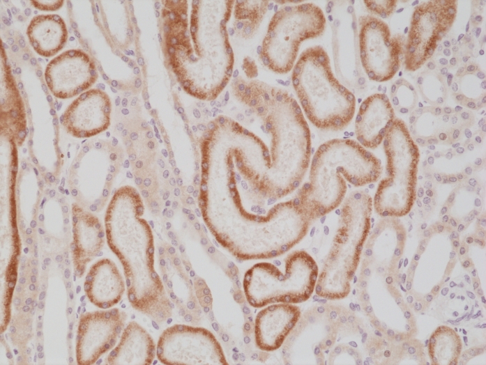 Antikörper Anti-AMACR (p504s) aus Kaninchen (RM349) - unkonj.