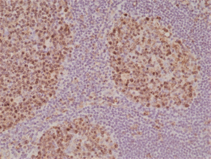 Antikörper Anti-Stathmin (STMN1) aus Kaninchen (RM350) - unkonj.