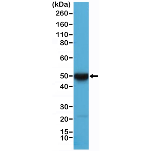 Antikörper Anti-Cytokeratin 17 (KRT17) aus Kaninchen (RM351) - unkonj.