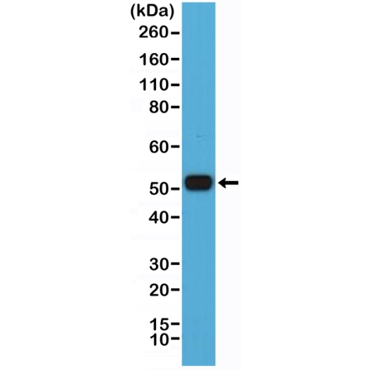 Antikörper Anti-MUM1/IRF4 aus Kaninchen (RM352) - unkonj.