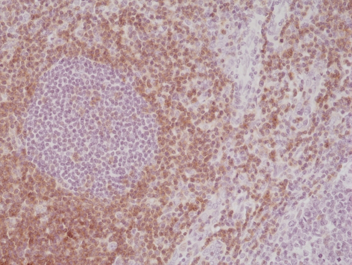 Antikörper Anti-CD5 (LEU1) aus Kaninchen (RM354) - unkonj.